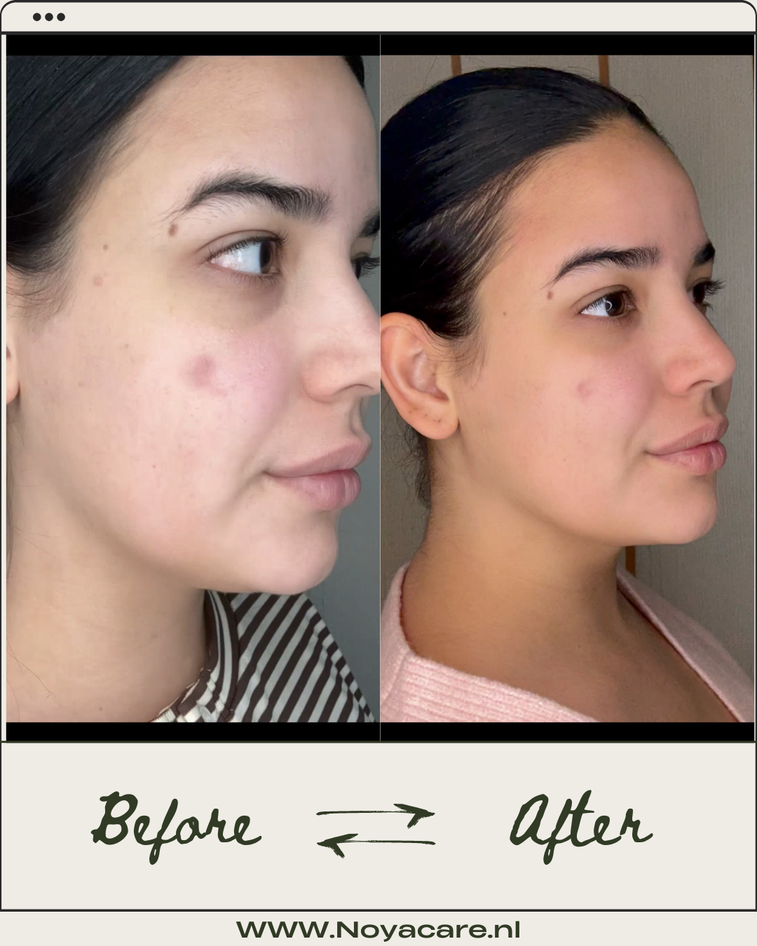 The Dark Spot Routine: A Targeted Approach to Clearer, Brighter Skin