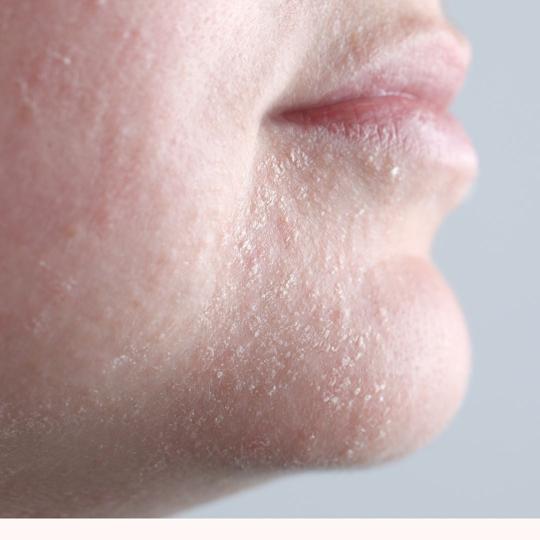 Winter Skin Survival Guide